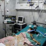 FILE PHOTO: Palestinian children, who are suffering from malnutrition, receive