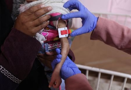 tagreuters.com2025binary_LYNXMPELBI0RO-VIEWIMAGE