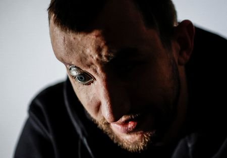 tagreuters.com2026binary_LYNXMPEM0L0CU-VIEWIMAGE