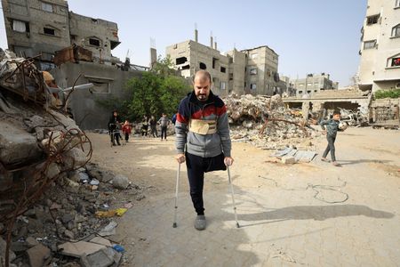 Gaza’s war amputees short of prostheses under Israeli restrictions