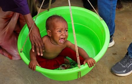 Child malnutrition soars in Baidoa